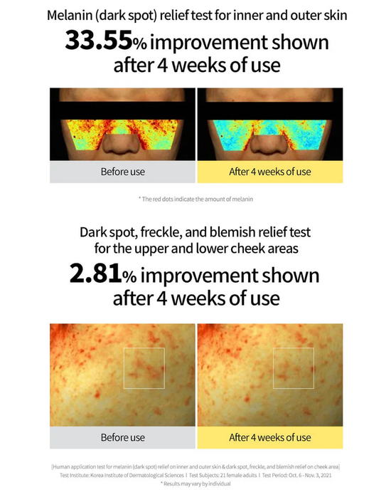 Green Tangerine Vita-C Dark Spot Care Serum